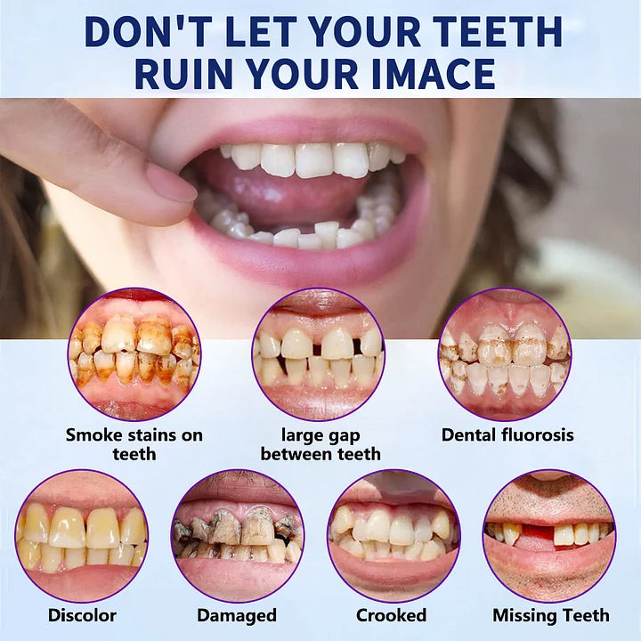 NESLEMY™-Advanced Full Denture Set (⏰Limited time discount last 30 minutes⏰)