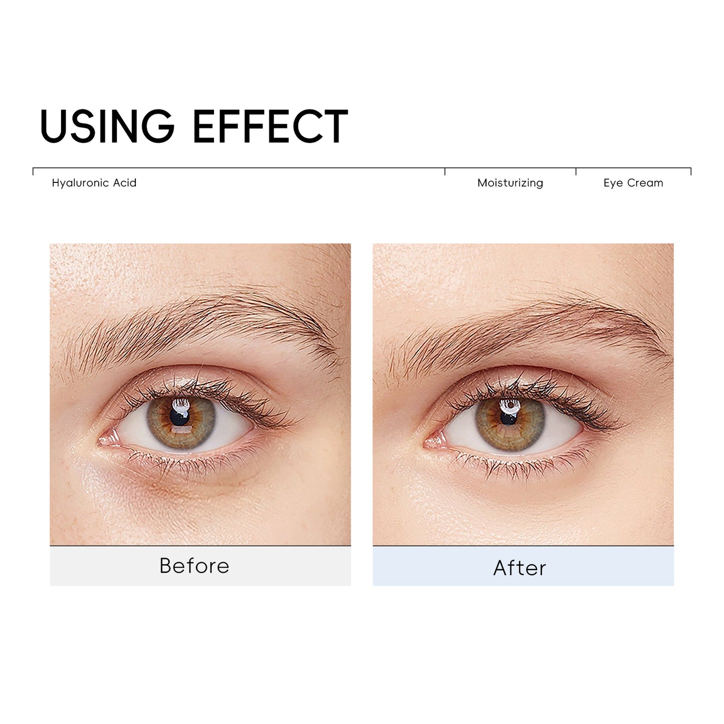 ✨Last Day Promotion 80% OFF - ✨Insideefy™HYALURONIC ACID MOISTURIZINCEYE CREAM