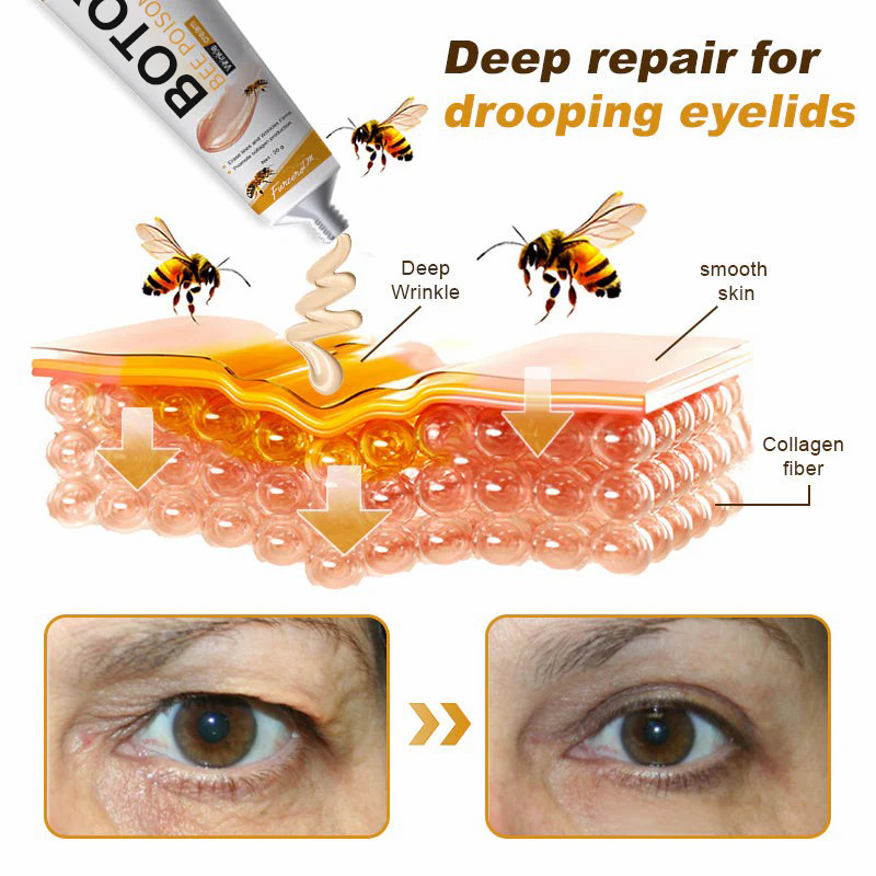 LOVILDS™ Botulin Bee Poison Wrinkle Removal Cream