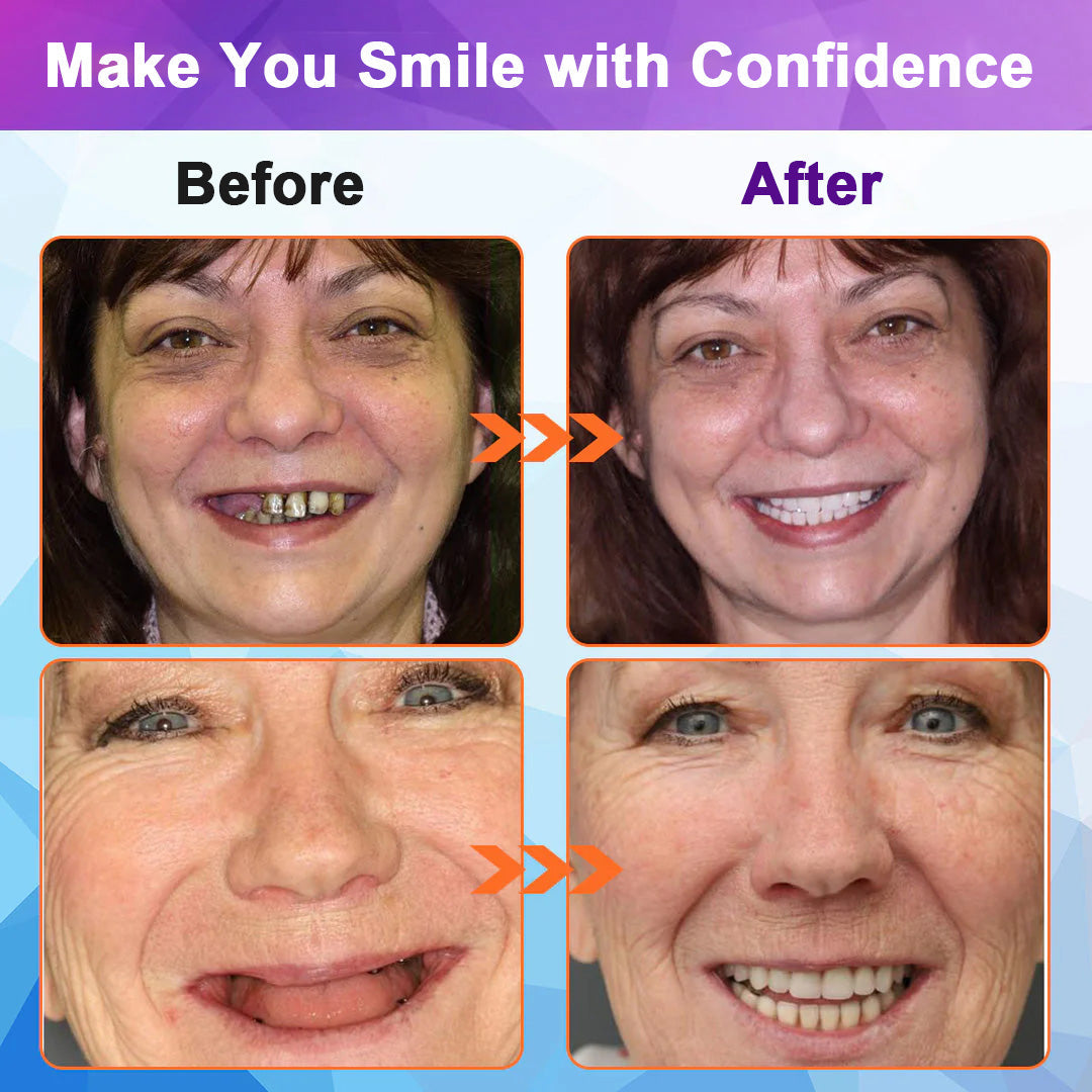 Experience Comfort with LOVILDS™ Silicone Lined Denture Set - (ADA Recommended)