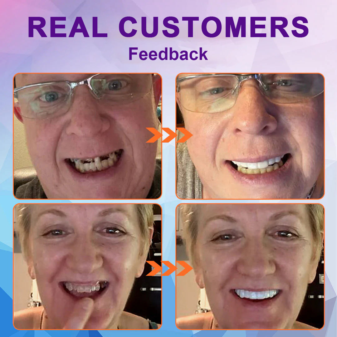 Experience Comfort with LOVILDS™ Silicone Lined Denture Set - (ADA Recommended)