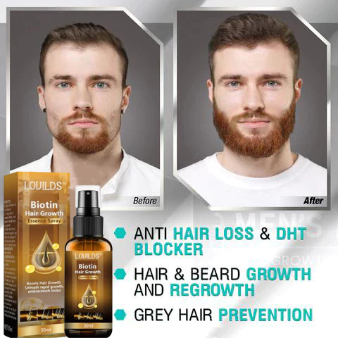 (🔥LAST DAY SALE-75% OFF) Lovilds™ Biotin Premium Hair Growth Serum