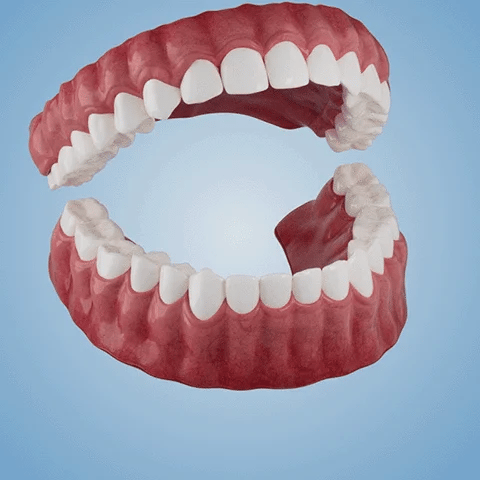 NESLEMY™-Advanced Full Denture Set (⏰Limited time discount last 30 minutes⏰)