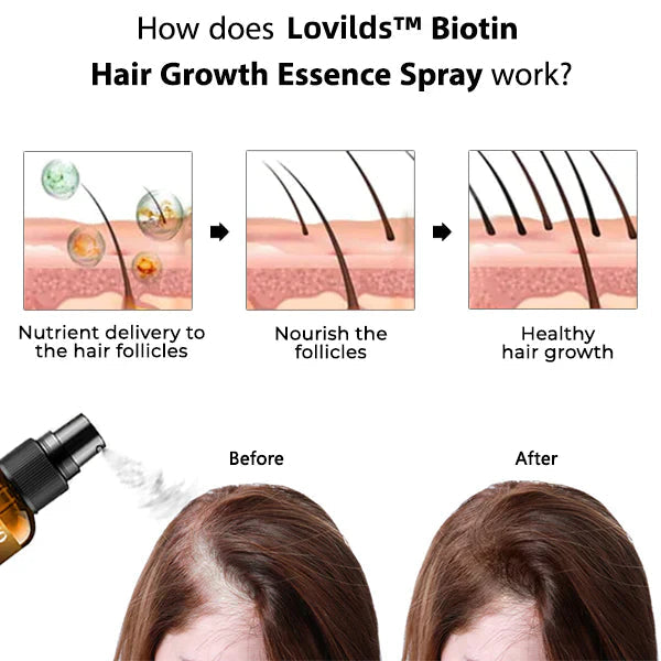 (🔥LAST DAY SALE-75% OFF) Lovilds™ Biotin Premium Hair Growth Serum
