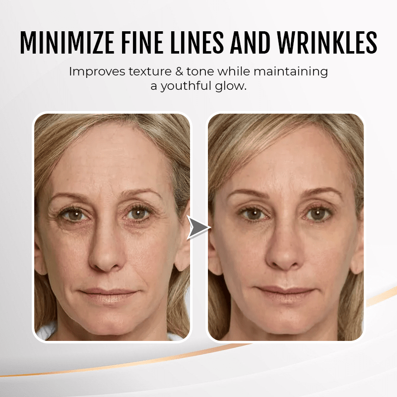 (🔥LAST DAY SALE-80% OFF) LOVILDS™ YouthfulLift Eye Firming Cream