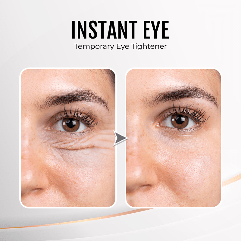 (🔥LAST DAY SALE-80% OFF) LOVILDS™ YouthfulLift Eye Firming Cream