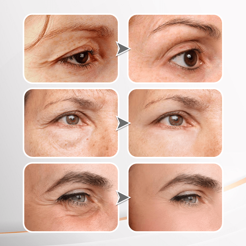 (🔥LAST DAY SALE-80% OFF) LOVILDS™ YouthfulLift Eye Firming Cream