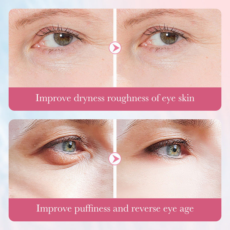 ✨🩵𝐋𝐚𝐬𝐭 𝐃𝐚𝐲 𝐃𝐢𝐬𝐜𝐨𝐮𝐧𝐭: 87% 𝐎𝐅𝐅🌸Lovids Collagen Sakura Multi-Effect Nourishing Eye Cream
