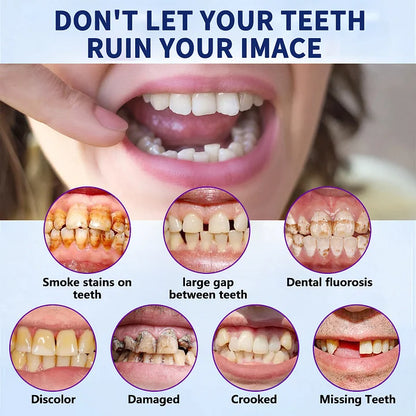 NESLEMY™-Advanced Full Denture Set (⏰Limited time discount last 30 minutes⏰)