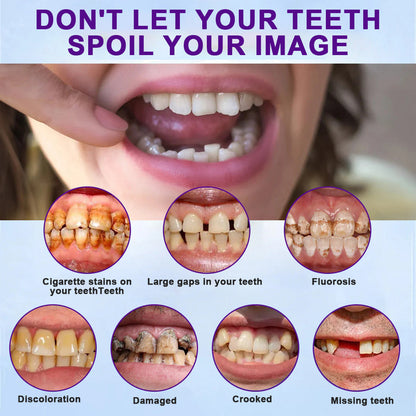 Experience Comfort with LOVILDS™ Silicone Lined Denture Set - (ADA Recommended)