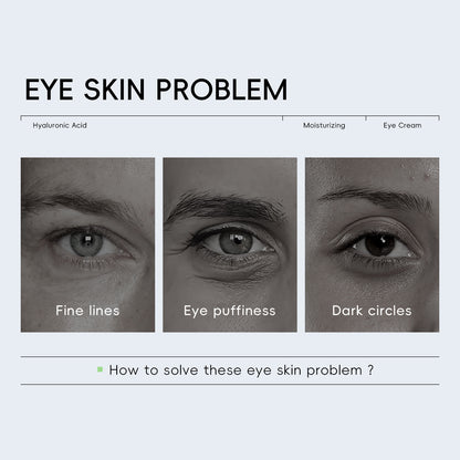 ✨Last Day Promotion 80% OFF - ✨Insideefy™HYALURONIC ACID MOISTURIZINCEYE CREAM