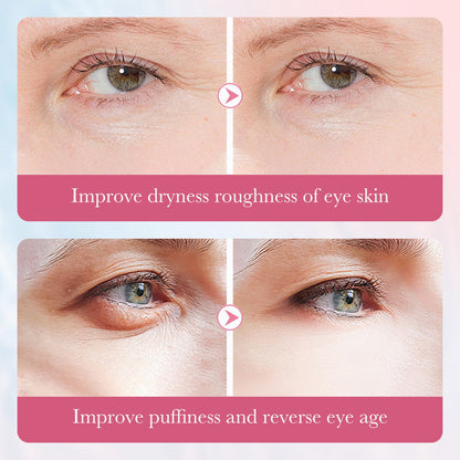 ✨🩵𝐋𝐚𝐬𝐭 𝐃𝐚𝐲 𝐃𝐢𝐬𝐜𝐨𝐮𝐧𝐭: 87% 𝐎𝐅𝐅🌸Lovids Collagen Sakura Multi-Effect Nourishing Eye Cream